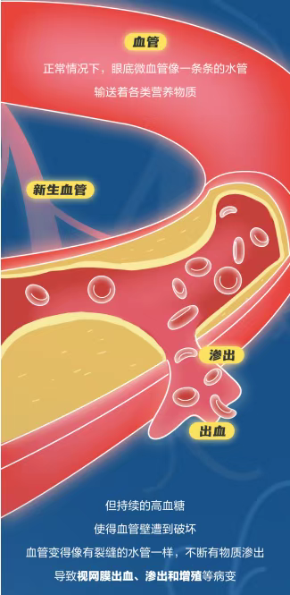 图片.png 图片.png